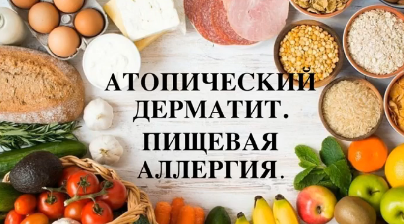 [Регина Доктор] Атопический дерматит. Пищевая алле_0.png